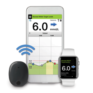 Eversense E3 CGM system 