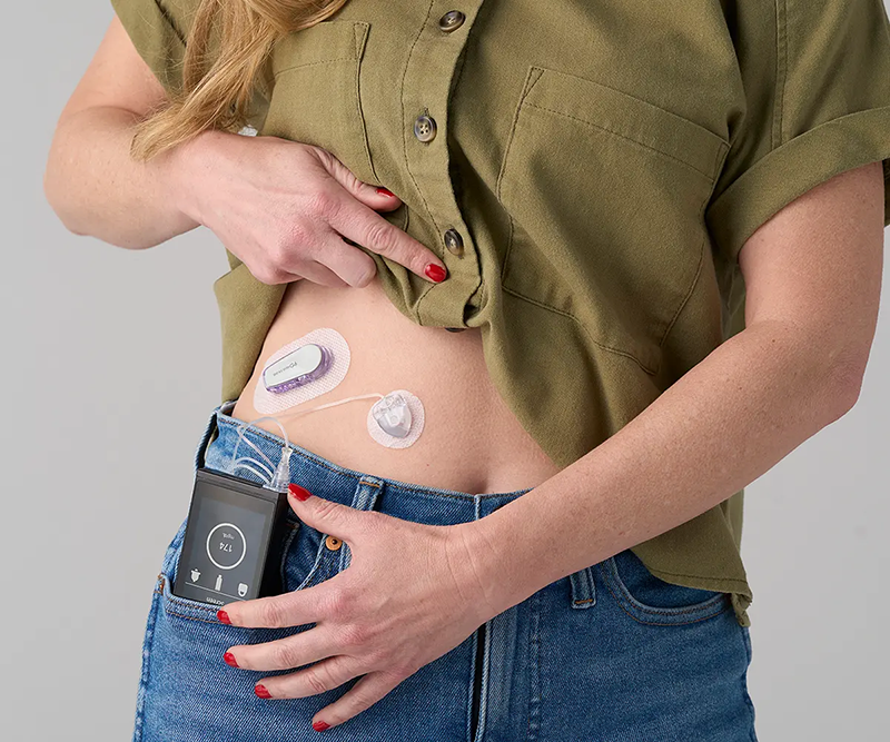 iLet bionic pancreas, Beta Bionics